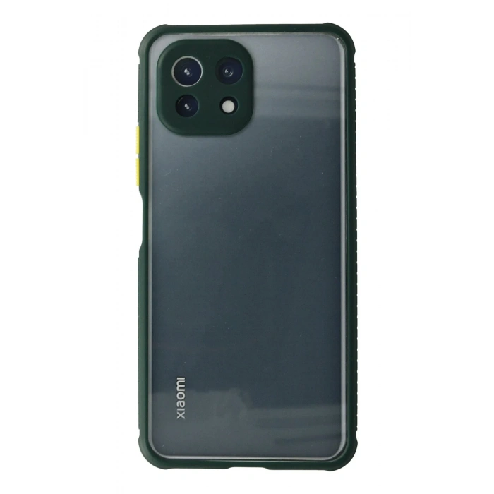 Newface Xiaomi Mİ 11 Lite Kılıf Miami Şeffaf Silikon - Koyu Yeşil