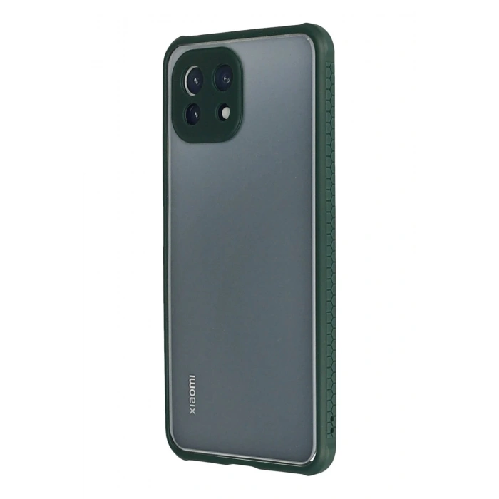 Newface Xiaomi Mİ 11 Lite Kılıf Miami Şeffaf Silikon - Koyu Yeşil