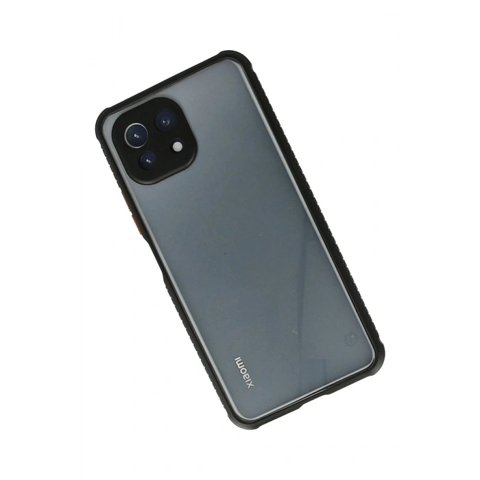 Newface Xiaomi Mİ 11 Lite Kılıf Miami Şeffaf Silikon - Siyah