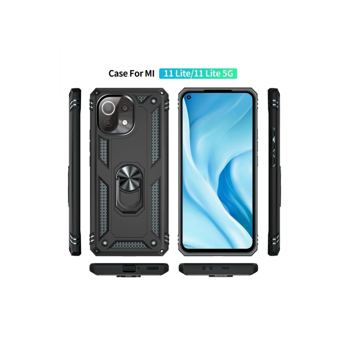 Newface Xiaomi Mİ 11 Lite Kılıf Sofya Yüzüklü Silikon Kapak - Siyah