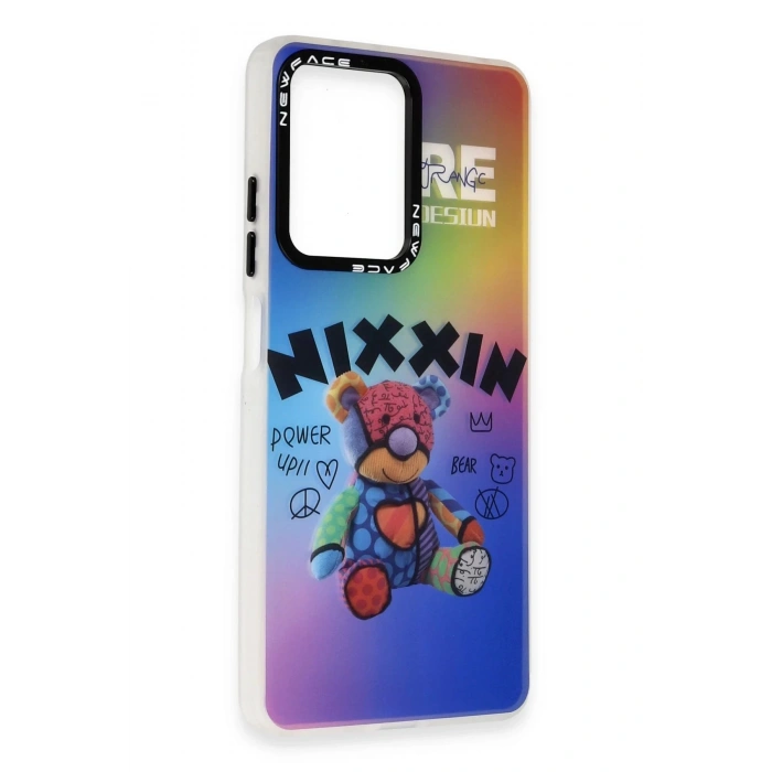 Newface Xiaomi Redmi Note 12 4G Kılıf Estoril Desenli Kapak - Estoril - 11