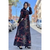 Moda Çizgi Tesettür Elbise