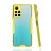 Newface Xiaomi Redmi Note 11T Kılıf Platin Silikon - Sarı