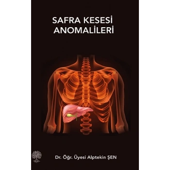 Safra Kesesi Anomalileri