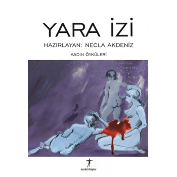Yara İzi