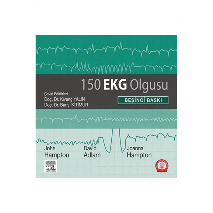 150 EKG Olgusu