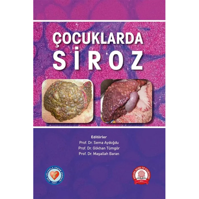 Çocuklarda Siroz