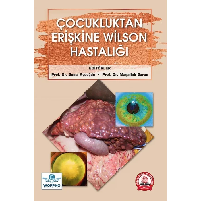 Çocukluktan Erişkine Wilson Hastalığı