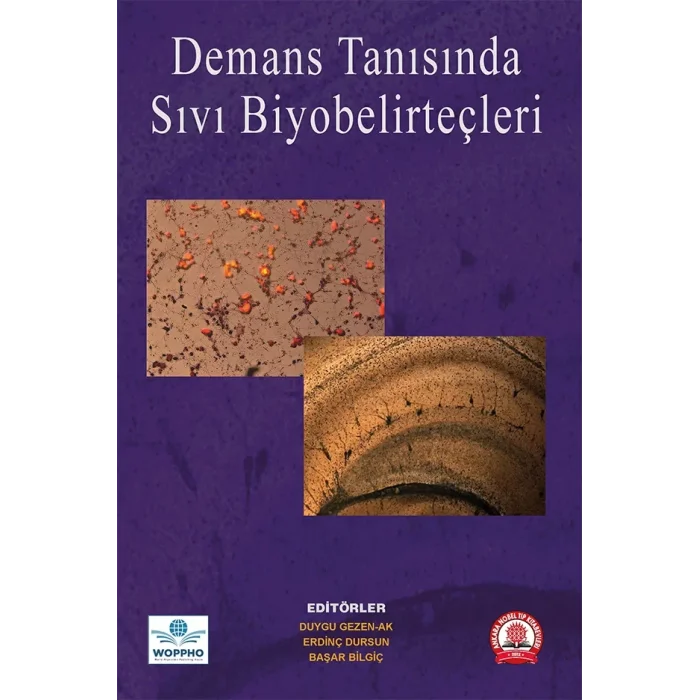 Demans Tanısında Sıvı Biyobelirteçler