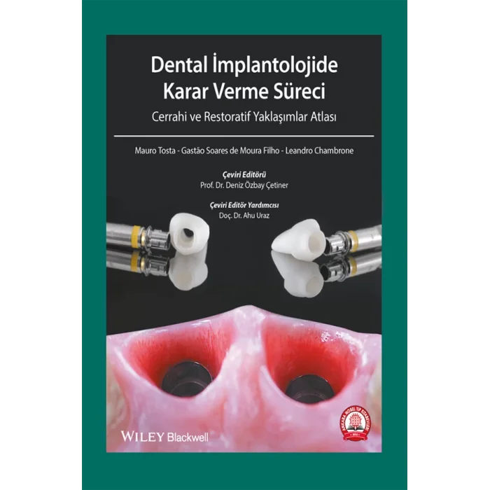 Dental İmplantolojide Karar Verme Süreci Cerrahi Atlası