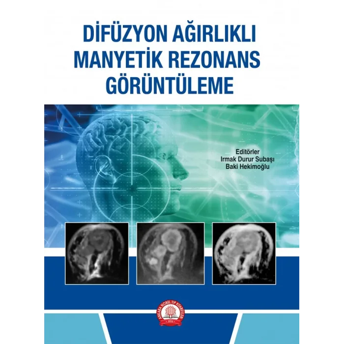 Difüzyon Ağırlıklı Manyetik Rezonans Görüntüleme