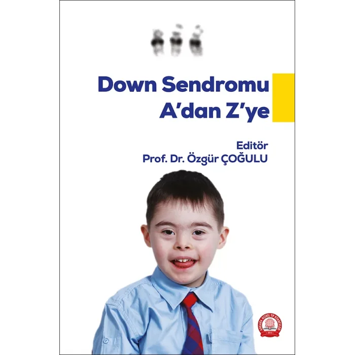 Down Sendromu A dan Z ye
