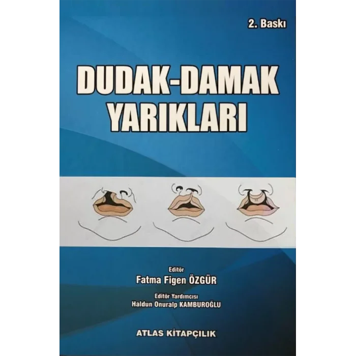 Dudak Damak Yarıkları