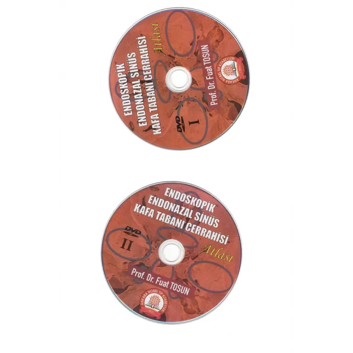 Endoskopik Endonazal Sinüs Kafa Tabanı Cerrahisi