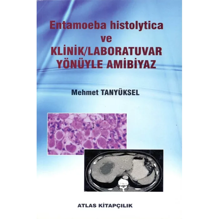 Entamoeba histolytica ve Klinik Laboratuvar Yönüyle Ambiyaz