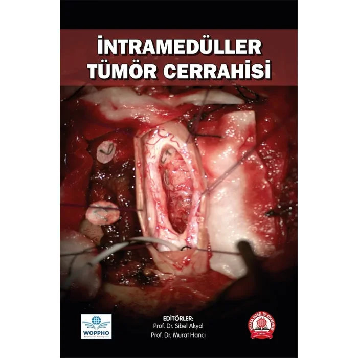 İntramedüller Tümör Cerrahisi