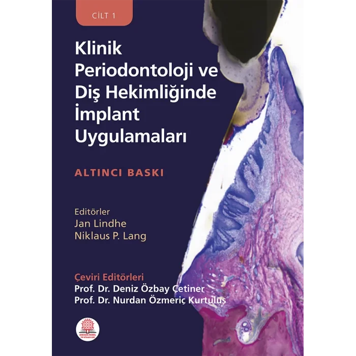 Klinik Periodontoloji ve Diş Hekimliğinde İmplant Uygulamaları