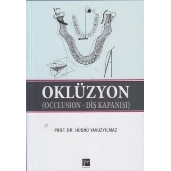 Oklüzyon