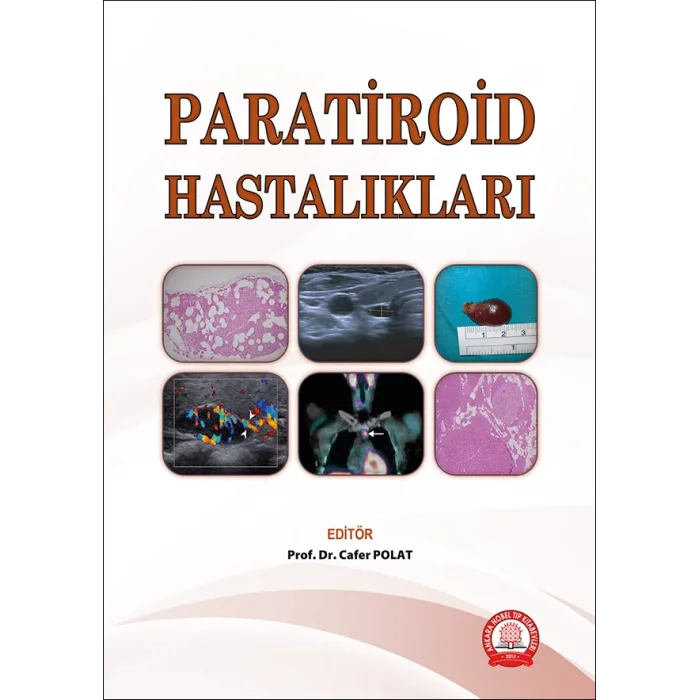 Paratiroid Hastalıkları