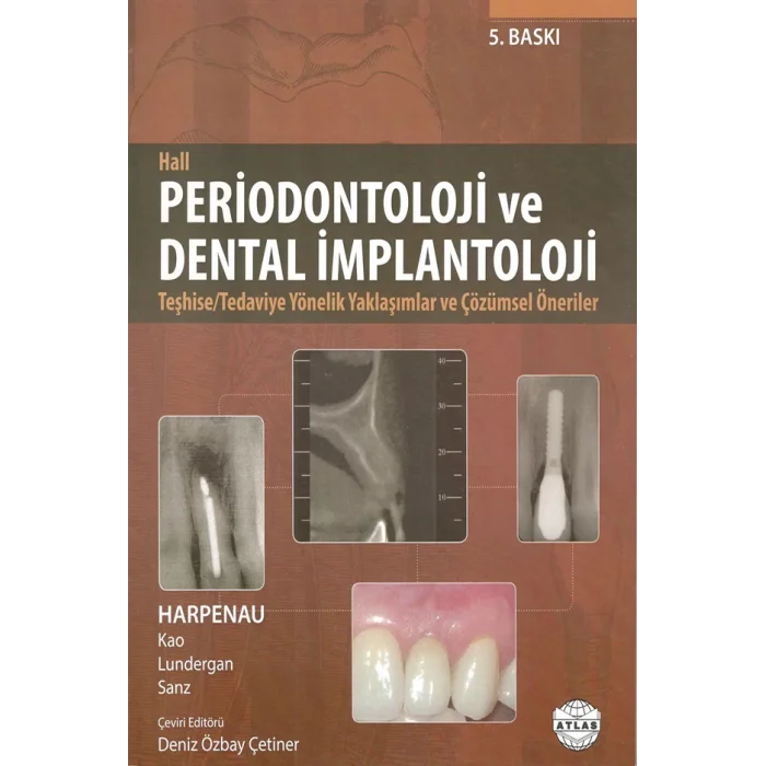 Periodontoloji ve Dental İmplantoloji - Hall