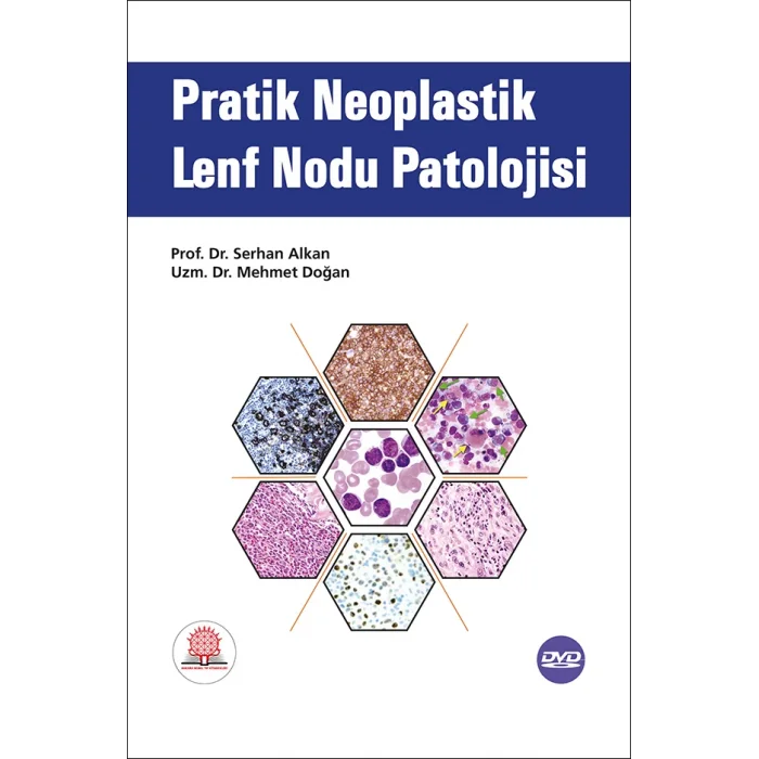 Pratik Neoplastik Lenf Nodu Patolojisi