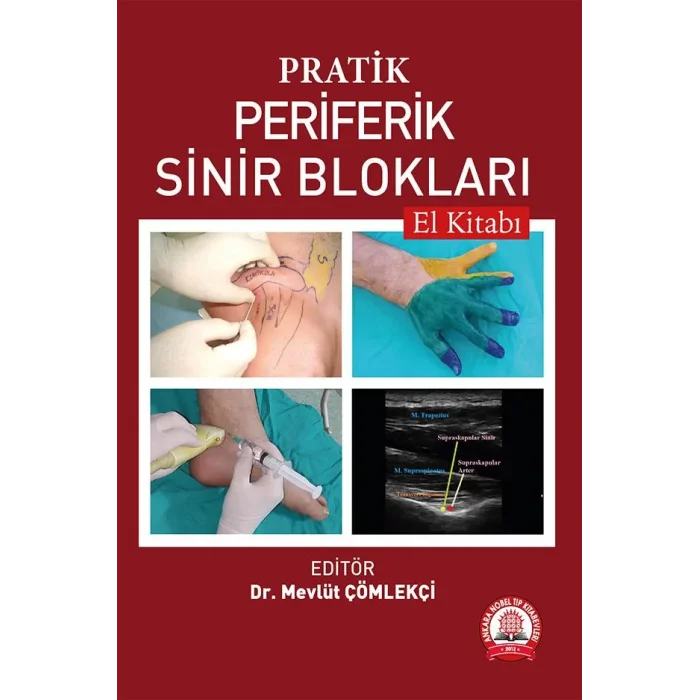 Pratik Periferik Sinir Blokları El Kitabı
