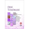 Deri Tümörleri