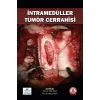 İntramedüller Tümör Cerrahisi