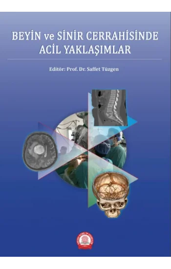 Beyin ve Sinir Cerrahisinde Acil Yaklaşımlar