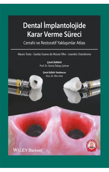 Dental İmplantolojide Karar Verme Süreci Cerrahi Atlası