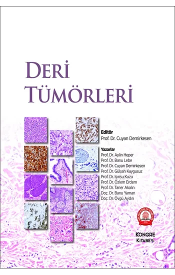 Deri Tümörleri