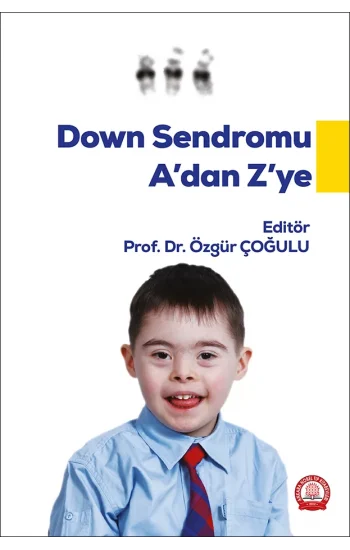 Down Sendromu A dan Z ye