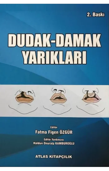 Dudak Damak Yarıkları