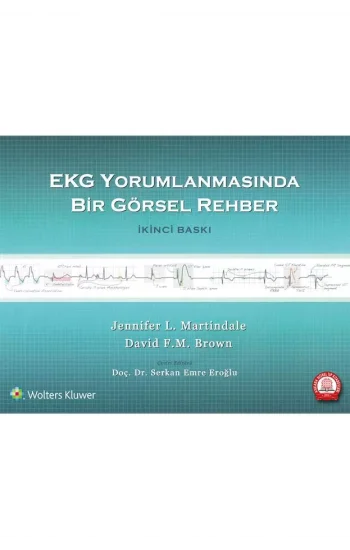 EKG Yorumlanmasında Bir Görsel Rehber
