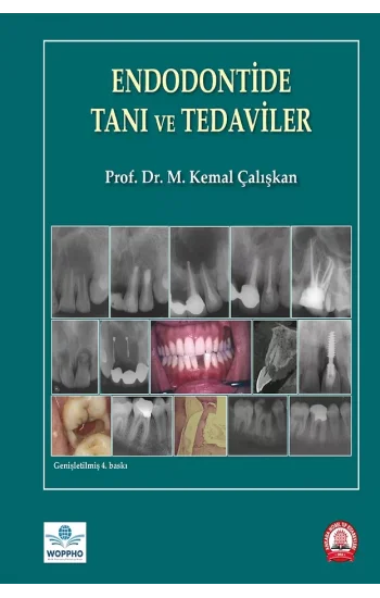 Endodontide Tanı ve Tedaviler