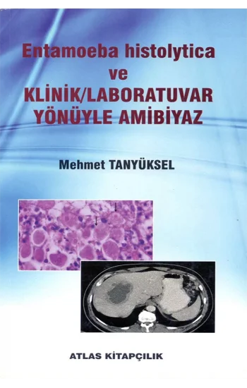 Entamoeba histolytica ve Klinik Laboratuvar Yönüyle Ambiyaz