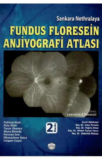 Fundus Floresein Anjiyografi Atlası