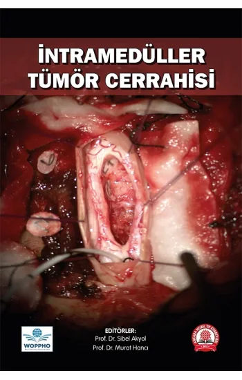 İntramedüller Tümör Cerrahisi
