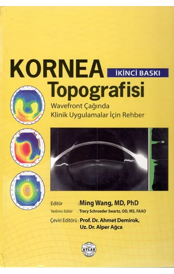 Kornea Topografisi