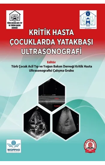 Kritik Hasta Çocuklarda Yatakbaşı Ultrasonografi