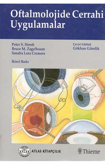 Oftalmolojide Cerrahi Uygulamalar
