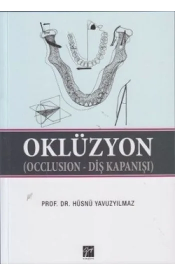Oklüzyon