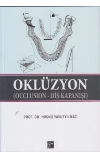 Oklüzyon