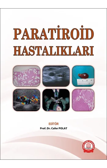 Paratiroid Hastalıkları