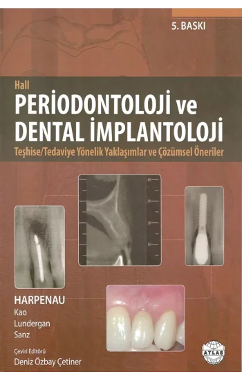 Periodontoloji ve Dental İmplantoloji - Hall