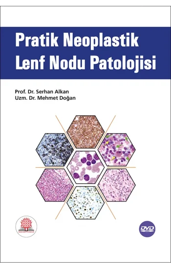 Pratik Neoplastik Lenf Nodu Patolojisi