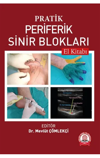 Pratik Periferik Sinir Blokları El Kitabı