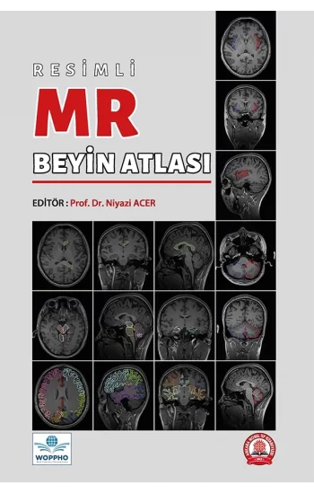 Resimli MR Beyin Atlası