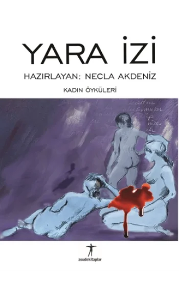 Yara İzi