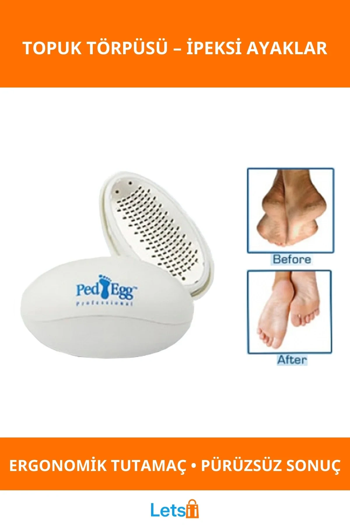 Ped Egg Topuk Törpüsü Yumuşak ve Pürüzsüz Topuklar İçin